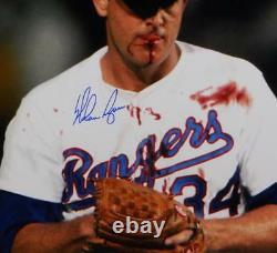 Nolan Ryan Signed Texas Rangers 16x20 Bloody Lip Photo- AI Verified/Ryan Holo B